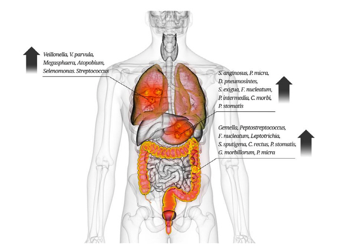 Promote the progression of certain harmful bacteria in the mouth, stomach cancer, lung cancer, etc