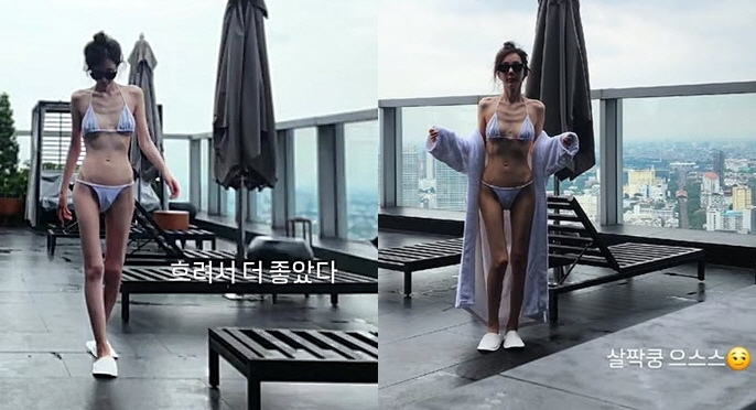 This is a necessary medical check-up...Shin Joo-ah, fans should go to the hospital with her extremely bone-thin body