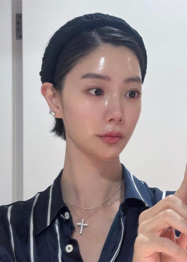 Clara's plastic surgery controversy has turned upside down..No makeup, no makeup, no makeup, no makeup, no makeup, no makeup