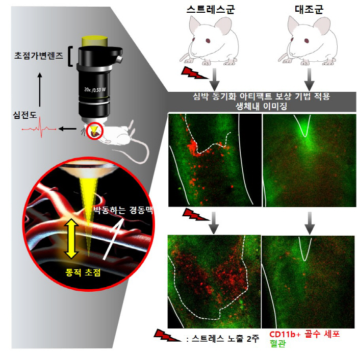 The reason for the occurrence of vascular disease due to chronic stress and cell tracking images are identified