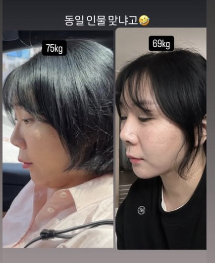 Huh Anna, 75kg → 69kg. Are you sure your jawline is the same person who has changed remarkably after losing it