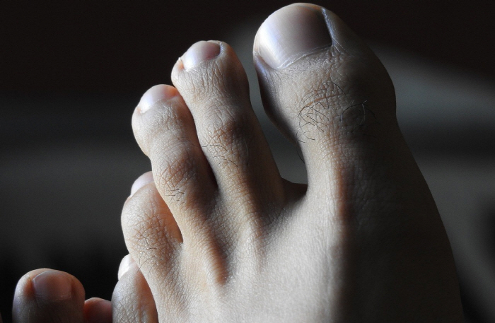 A university that gathered more than 30,000 toenails, there was a reason