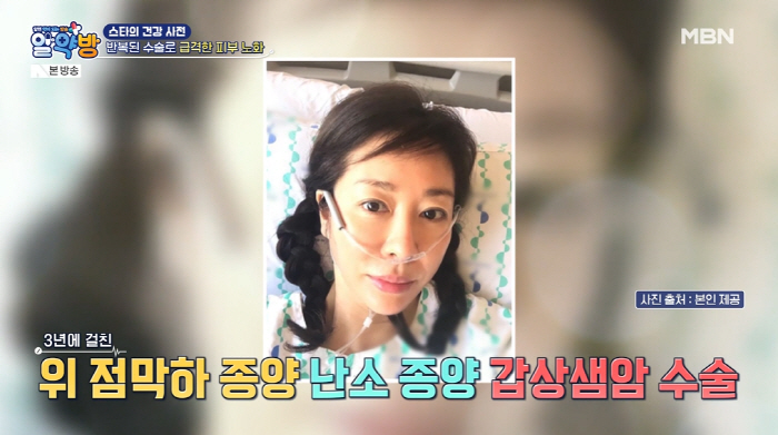 Yoon Seok-min's mother-in-law, Kim Ye-ryeong, underwent surgery for thyroid cancer → ovarian tumor Wrinkles stretch with 3 general anesthesia