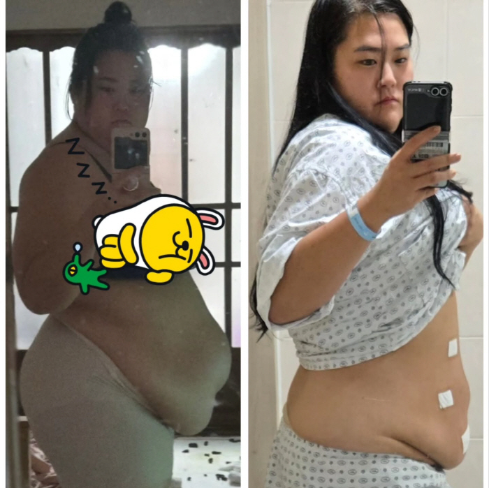 Mina's sister-in-law, amazing 150→99kg weight loss change..a 180-degree different body