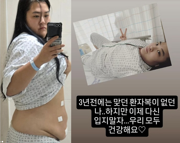 150 → 99 kg Mina's sister-in-law, a fat past shock without a patient's suit