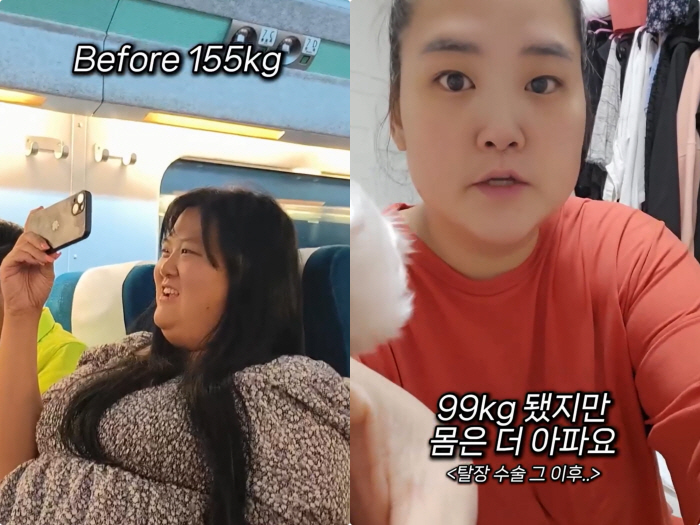 150kg Mina's sister-in-law, 99kg even if she lost 50kg, super obese..I need to lose weight so that I don't get sick