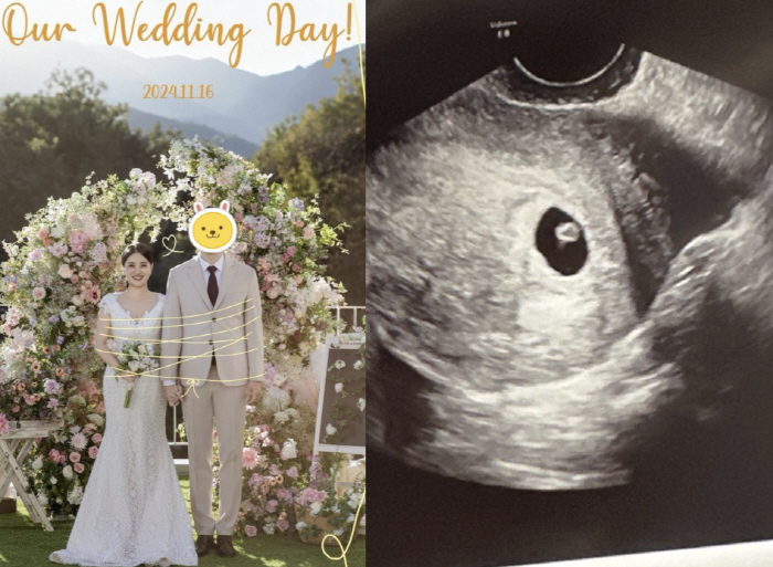 Yoo So-min is pregnant as soon as she remarries..Mom-to-be in the 7th week. 