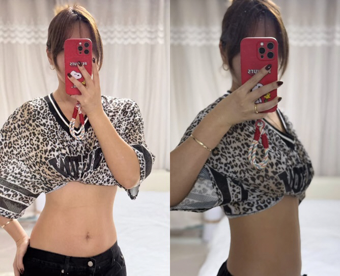 Bae Yoon-jung, who lost 13kg, boldly exposed to suspicion of maintenance..For the face, lifting treatment