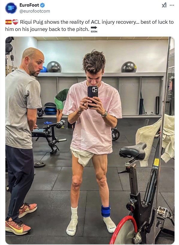 OMG! Football star's dwarfed legs during rehabilitation shocked soccer fans...MLS star Pucci's sad injury after-effects