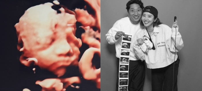 Son Dam-bi, 2nd generation daughter, clear nose in stereoscopic ultrasound ♥ Lee Kyu-hyuk, please look like a mother