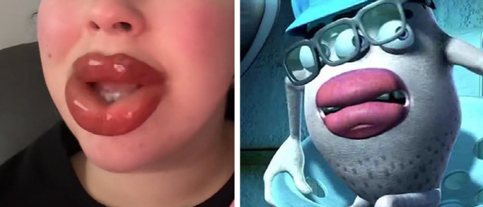 5x bigger after lip tattooing...It turns into an animation monster's lips