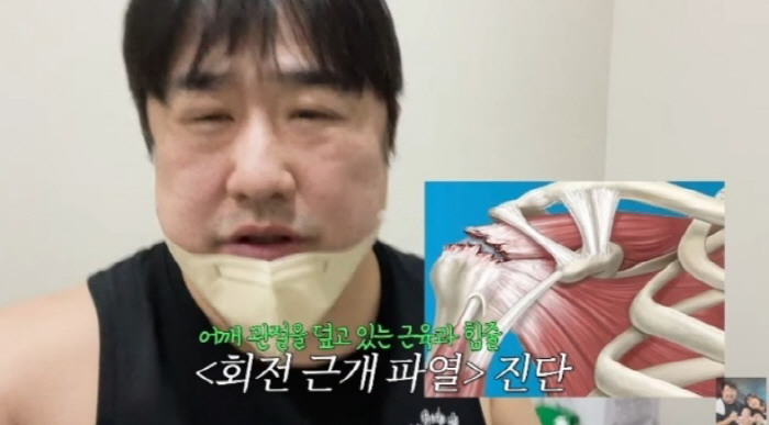  My left arm is crooked Kang Jae-joon, an 8-month-old father, was shocked by the rupture of the rotator cuff (Kiyu TV)