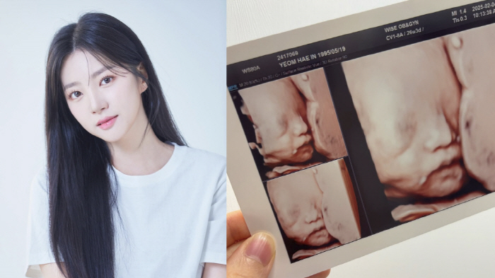 Ra-boom Hae-in is already a mother of two children. She's showing off her stereoscopic ultrasound