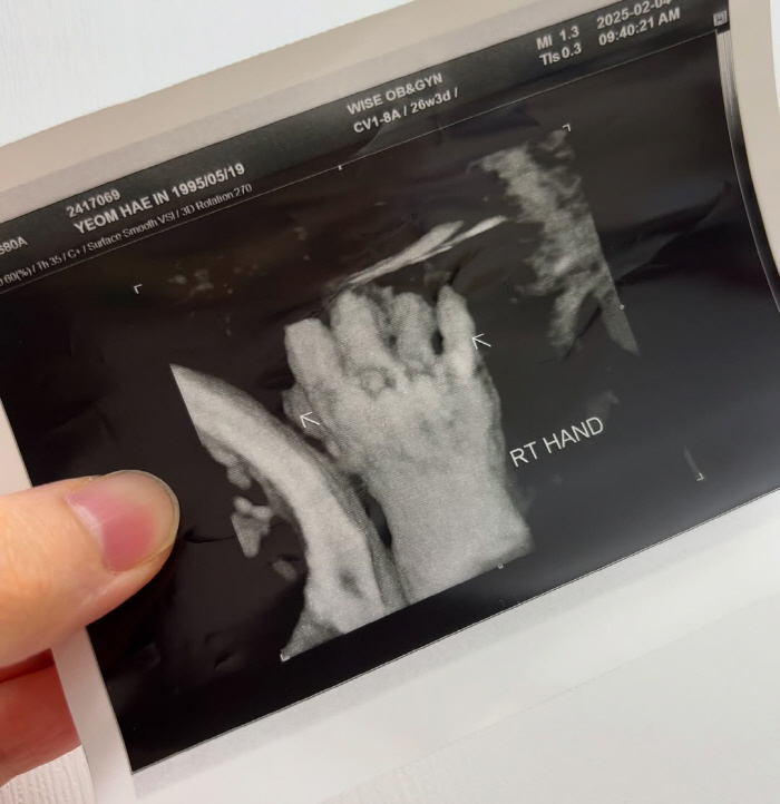 Ra-boom Hae-in is already a mother of two children. She's showing off her stereoscopic ultrasound