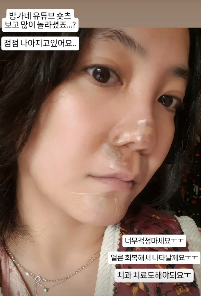 Ko Eun-ah, a mid-sized car with a serious facial injury, and a front tooth in the hospital