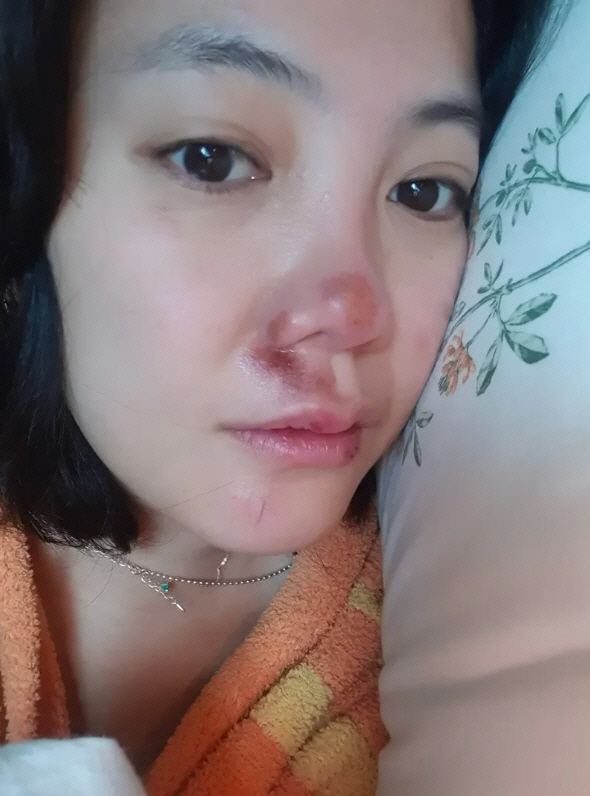 Goeun, I'm afraid I'll get scars on my nose that cost me a medium-sized car