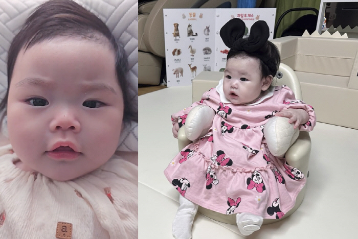 Park Soo-hong ♥ Kim Daye, 4-month-old daughter is changing her beauty with double eyelids